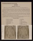 Abdomen. Abdominal Cavity - no. 7